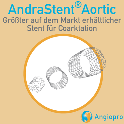 AndraStent